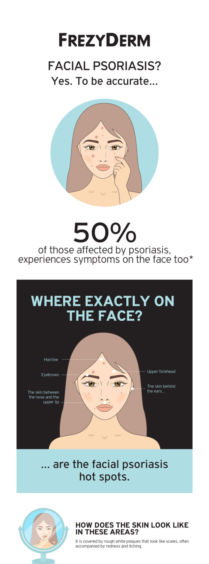 infographic facial psoriasis 1